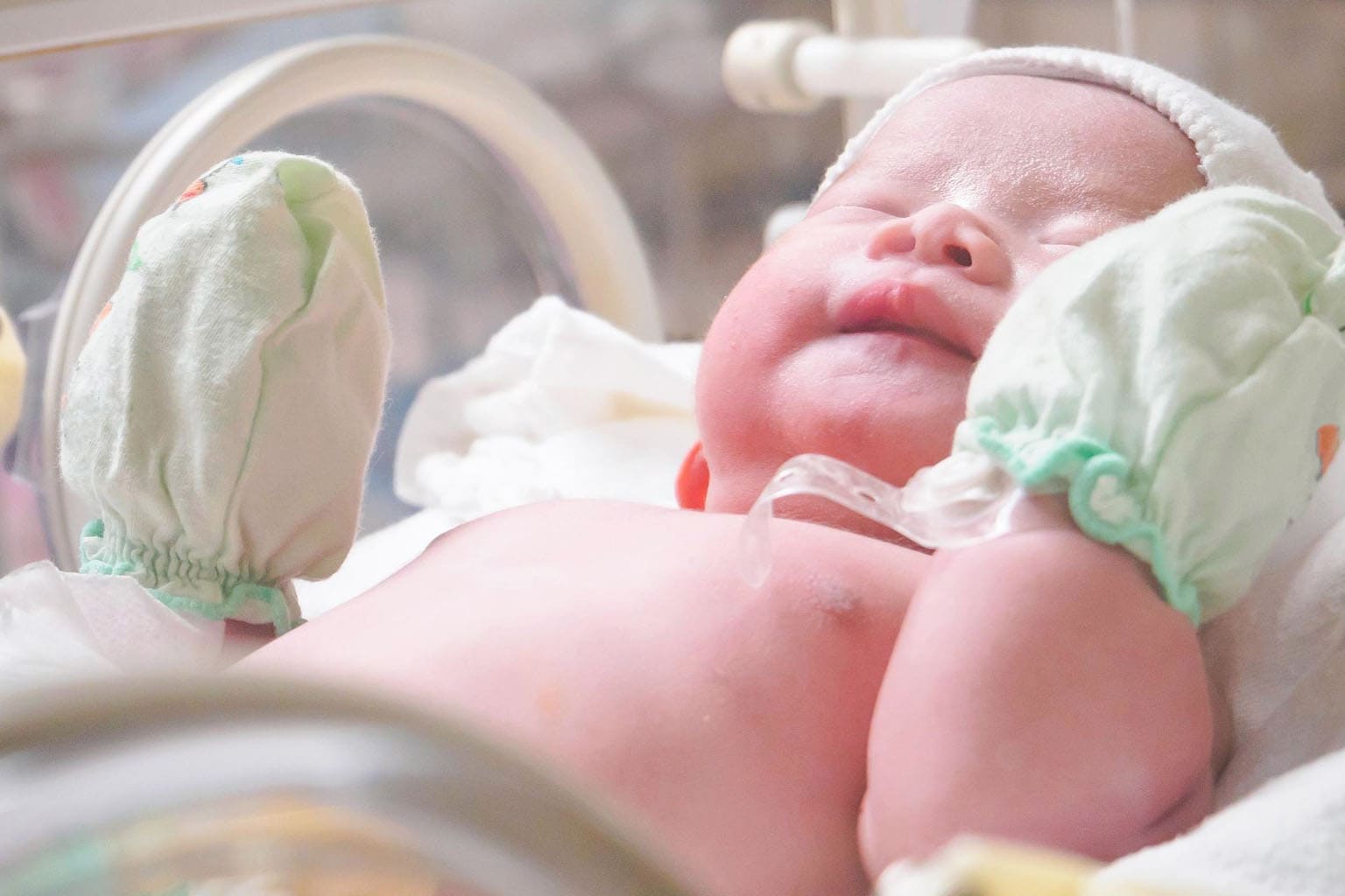 Nouveau-né en maternité avec tétine, respiration de bébé surveillée après une laryngomalacie